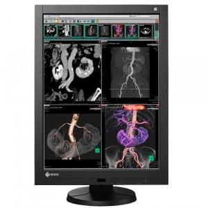 Eizo RX340-BK 21.2in Lcd Clr 1400 1 3mp    1536x2048 Medical Radiforce