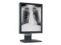 Barco K9601733 Coronis 5mp Mdcg 5121 Medical Display