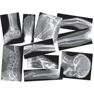 Roylco Inc Roylco Broken Bones X-rays Set - Theme/Subject: