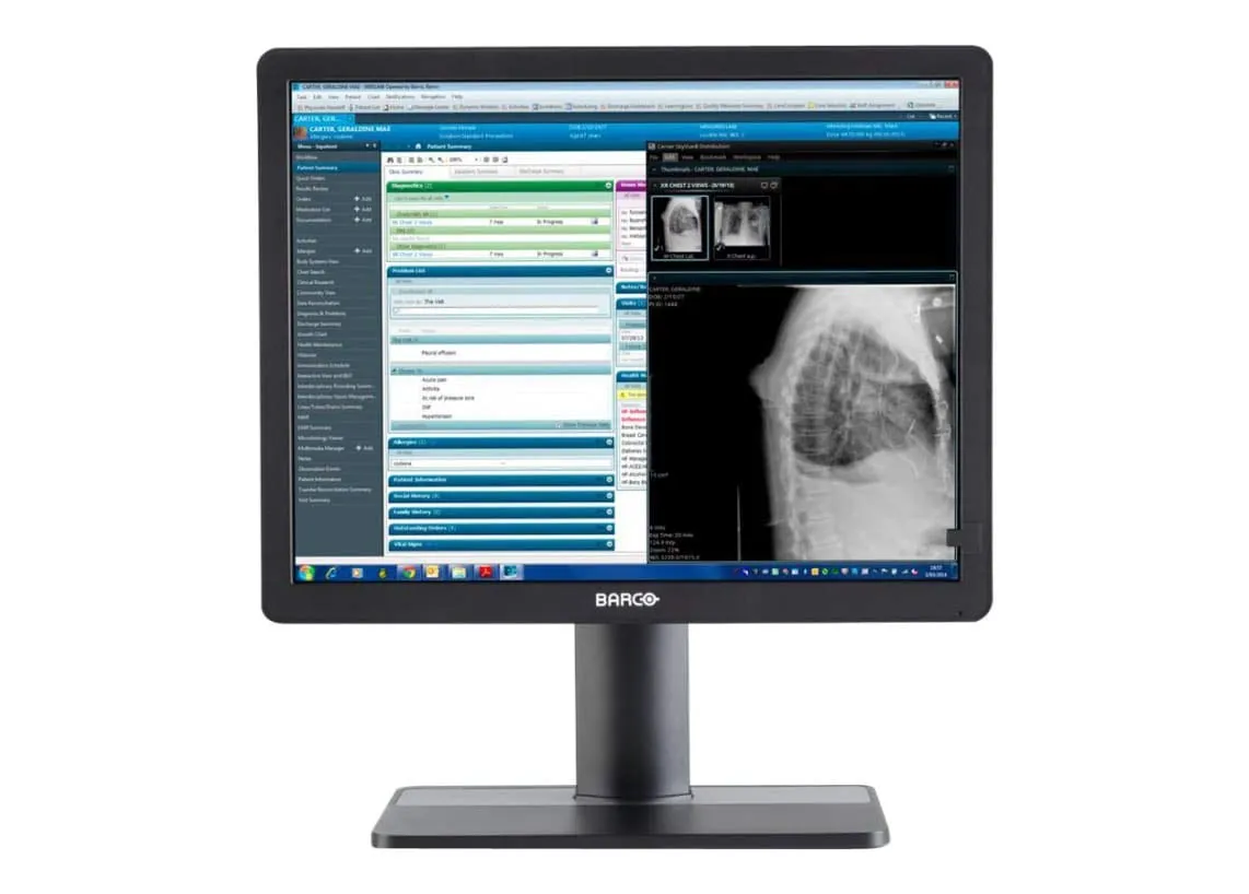 Barco K9350053 Mdrc-2321 Snib: 21 2mp Medical Clinical Review Color Di